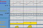 Vorhersage Meteomedia Fürth